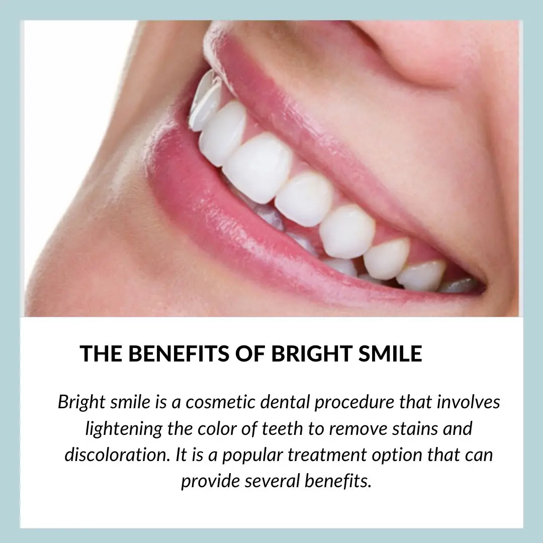 The Benefits of Bright Smile