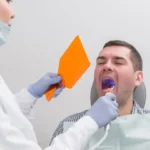 Root Canal on Front Tooth: A Simplified Guide