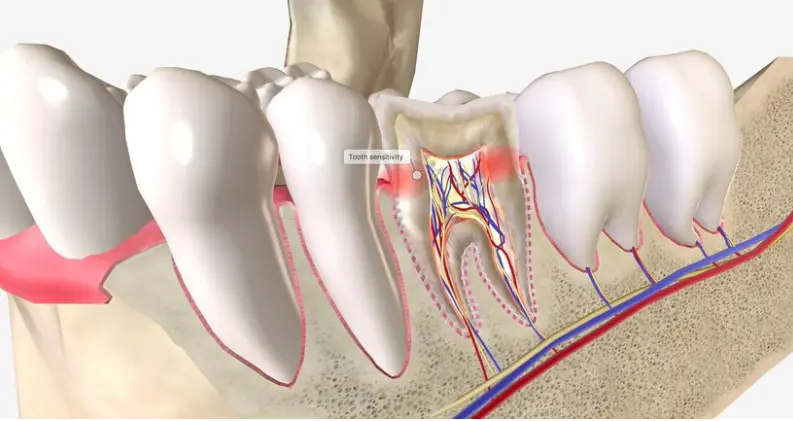 The Steps of a Root Canal Procedure