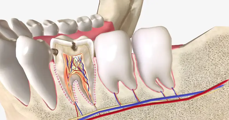 Common Questions About Root Canals